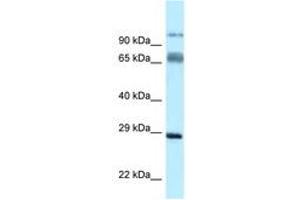 Image no. 1 for anti-Proline Rich Transmembrane Protein 1 (PRRT1) (N-Term) antibody (ABIN6747874) (PRRT1 Antikörper  (N-Term))