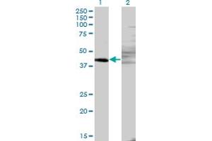 Western Blot analysis of ZNF193 expression in transfected 293T cell line by ZNF193 monoclonal antibody (M06), clone 3G6.