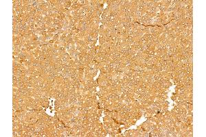 ABIN7094734 and ABIN7098785 at 1/100 staining Rat liver tissue by IHC-P. (ALDH9A1 Antikörper  (C-Term))