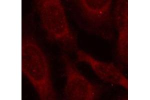 Immunofluorescence (IF) image for anti-Coactivator-Associated Arginine Methyltransferase 1 (CARM1) (pSer228) antibody (ABIN3020121) (CARM1 Antikörper  (pSer228))