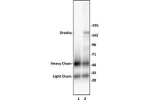 Drosha antibody (pAb) tested by Immunoprecipitation.