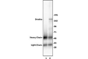 Drosha antibody (pAb) tested by Immunoprecipitation. (DROSHA Antikörper  (C-Term))