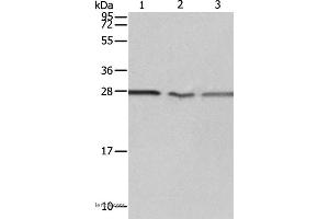 Western blot analysis of Jurkat, A549 cell and Human fetal kidney tissue, using PSMD9 Polyclonal Antibody at dilution of 1:750 (PSMD9 Antikörper)