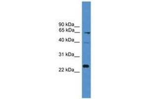 Image no. 1 for anti-CD7 (CD7) (AA 51-100) antibody (ABIN6746549) (CD7 Antikörper  (AA 51-100))