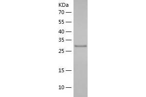 Western Blotting (WB) image for Sulfotransferase Family, Cytosolic, 2A, Dehydroepiandrosterone (DHEA)-Preferring, Member 1 (SULT2A1) (AA 1-285) protein (His tag) (ABIN7286979) (SULT2A1 Protein (AA 1-285) (His tag))