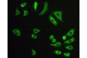 Detection of CS in Hela cells using Polyclonal Antibody to Citrate Synthase (CS) (CS Antikörper  (AA 56-312))