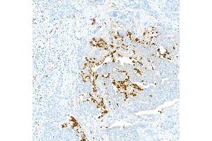 Immunohistochemistry (IHC) image for anti-S100 Calcium Binding Protein A9 (S100A9) (AA 64-114) antibody (ABIN7449432) (Rekombinanter S100A9 Antikörper  (AA 64-114))