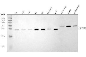 Western blot analysis of PSMB4 using anti-PSMB4 antibody (ABIN7600532).