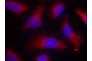 Image no. 3 for anti-Microtubule-Associated Protein tau (MAPT) (pSer262) antibody (ABIN196808) (MAPT Antikörper  (pSer262))