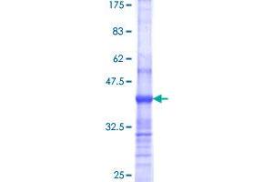 Image no. 1 for Supervillin (SVIL) (AA 1679-1786) protein (GST tag) (ABIN1321952)
