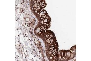 Immunohistochemical staining of human nasopharynx with TMEM111 polyclonal antibody  shows strong cytoplasmic and membranous positivity in respiratory epithelial cells at 1:50-1:200 dilution. (EMC3 Antikörper)