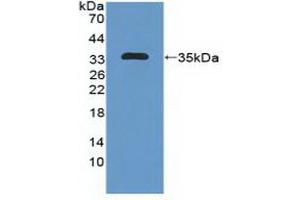 Detection of Recombinant MAP1B, Human using Polyclonal Antibody to Microtubule Associated Protein 1B (MAP1B)
