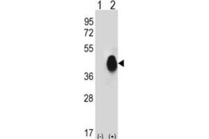 Western Blotting (WB) image for anti-CD38 antibody (ABIN3001687) (CD38 Antikörper)