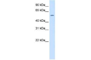 WB Suggested Anti-Thrb Antibody Titration:  1. (THRB Antikörper  (N-Term))