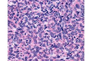 Immunohistochemistry (IHC) image for anti-Purinergic Receptor P2Y, G-Protein Coupled, 10 (P2RY10) (Extracellular Domain) antibody (ABIN1049202)