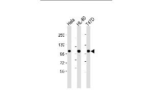 All lanes : Anti-EZH2 Antibody at 1:2000 dilution Lane 1: Hela whole cell lysate Lane 2: HL-60 whole cell lysate Lane 3: T47D whole cell lysate Lysates/proteins at 20 μg per lane. (EZH2 Antikörper)
