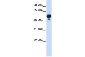 WB Suggested Anti-RING1 Antibody Titration: 0. (RING1 Antikörper  (Middle Region))
