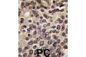 Immunohistochemistry (IHC) image for anti-PKN beta antibody (ABIN3003586) (PKN beta Antikörper)
