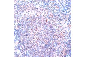 Immunohistochemistry of paraffin-embedded mouse spleen using RPS6K antibody (5718) at dilution of 1:100 (40x lens). (RPS6KA1 Antikörper  (C-Term))
