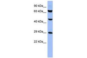 Image no. 1 for anti-Small Nuclear Ribonucleoprotein Polypeptides B and B1 (SNRPB) (AA 35-84) antibody (ABIN6742979) (SNRPB Antikörper  (AA 35-84))
