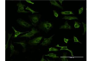 Immunofluorescence of monoclonal antibody to PCBP2 on HeLa cell.