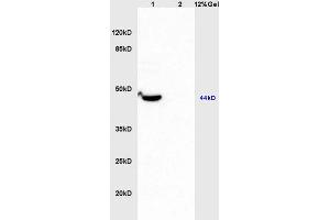 Lane 1: mouse brain lysates Lane 2: human colon carcinoma lysates probed with Anti MMP-23 Polyclonal Antibody, Unconjugated (ABIN759176) at 1:200 in 4 °C. (Matrix Metallopeptidase 23 (MMP23) (AA 281-380) Antikörper)