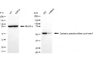 Western blotting analysis using dyskerin pseudouridine synthase 1 antibody (ABIN7798408).