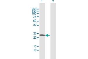 Western Blot analysis of COMT expression in transfected 293T cell line by COMT MaxPab polyclonal antibody.