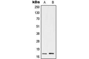 Western blot analysis of UBE2A/B expression in HeLa (A), Jurkat (B) whole cell lysates. (UBE2A/B (C-Term) Antikörper)