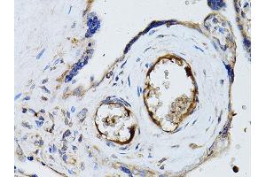 Immunohistochemistry of paraffin-embedded human placenta using RYR2 Antibody (ABIN5970123) at dilution of 1/100 (40x lens). (RYR2 Antikörper)