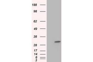Image no. 1 for anti-Ketohexokinase (KHK) antibody (ABIN1499024) (Ketohexokinase Antikörper)