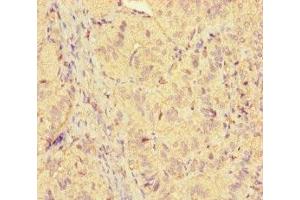Immunohistochemistry of paraffin-embedded human adrenal gland tissue using ABIN7158468 at dilution of 1:100 (ICE1 (AA 1213-1505) Antikörper)