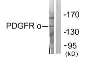 Western blot analysis of extracts from HepG2 cells, using PDGFR alpha Antibody.