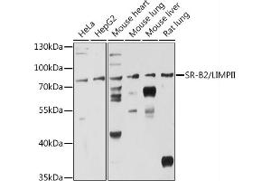 Western blot analysis of extracts of various cell lines, using SR-B2/LIMPII antibody (ABIN6127596, ABIN6147412, ABIN6147414 and ABIN6216462) at 1:3000 dilution. (SCARB2 Antikörper  (AA 200-380))