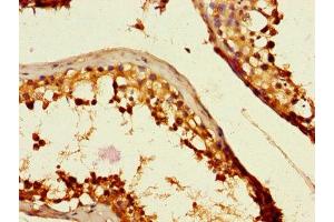 Immunohistochemistry of paraffin-embedded human testis tissue using ABIN7146159 at dilution of 1:100 (C2CD3 Antikörper  (AA 2079-2265))