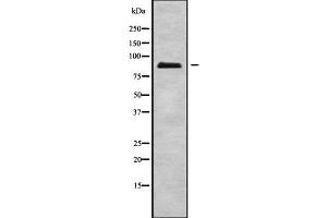 Western blot analysis of ERCC2 using A549 whole cell lysates (ERCC2 Antikörper  (C-Term))