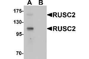Western blot analysis of RUSC2 in SK-N-SH cell lysate with RUSC2 antibody at 1 µg/mL in (A) the absence and (B) the presence of blocking peptide (RUSC2 Antikörper  (N-Term))