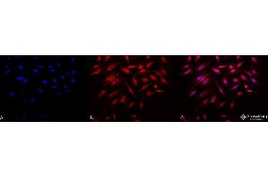Immunofluorescence (fixed cells) (IF/ICC) image for anti-RAB4A, Member RAS Oncogene Family (RAB4A) (C-Term) antibody (PerCP) (ABIN2486643)