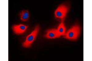 Immunofluorescent analysis of 14-3-3 epsilon staining in NIH3T3 cells. (YWHAE Antikörper  (C-Term))