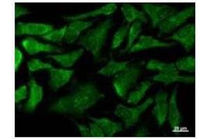 Immunostaining analysis in HeLa cells. (COX4NB Antikörper)