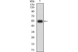 Western blot analysis using CD132 mAb against human CD132 (AA: extra 23-262) recombinant protein. (IL2RG Antikörper  (AA 23-262))