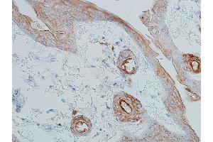 Immunohistochemistry (IHC) image for anti-Cadherin 1, Type 1, E-Cadherin (Epithelial) (CDH1) (AA 155-707) antibody (ABIN7454024)