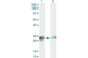 Western Blot analysis of BIN3 expression in transfected 293T cell line by BIN3 monoclonal antibody (M01A), clone 3G3. (BIN3 Antikörper  (AA 1-199))