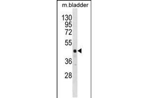 Western blot analysis in mouse bladder tissue lysates (35ug/lane). (RBM41 Antikörper  (C-Term))