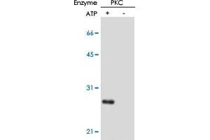 In vitro kinase reaction and detection of phosphorylation of CPI-17 at Thr38 residue by using CPI-17 (phospho T38) monoclonal antibody, clone AK-1F11 . (CPI-17 Antikörper  (pThr38))
