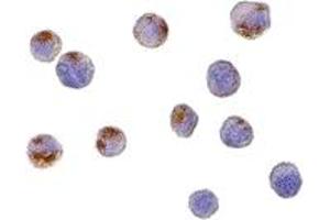 Immunohistochemistry (IHC) image for anti-Complement C1q Tumor Necrosis Factor-Related Protein 6 (C1QTNF6) (C-Term) antibody (ABIN1030348) (CTRP6 Antikörper  (C-Term))