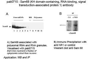 Image no. 1 for anti-KH Domain-Containing, RNA-Binding, Signal Transduction-Associated Protein (Sam68) antibody (ABIN559716) (KH Domain-Containing, RNA-Binding, Signal Transduction-Associated Protein (Sam68) Antikörper)