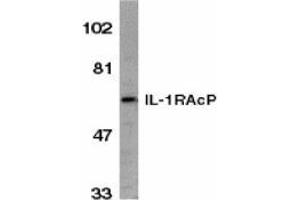 Western blot analysis of IL-1RAcP in HeLa whole cell lysate with AP30411PU-N IL-1RAcP antibody (C2) at 1/1000 dilution.