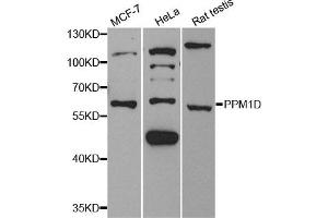 Western Blotting (WB) image for anti-Protein Phosphatase, Mg2+/Mn2+ Dependent, 1D (PPM1D) antibody (ABIN1882331) (PPM1D Antikörper)