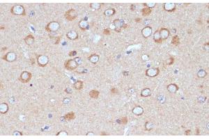 Immunohistochemistry of paraffin-embedded Mouse brain using COPG2 Polyclonal Antibody at dilution of 1:100 (40x lens). (COPG2 Antikörper)